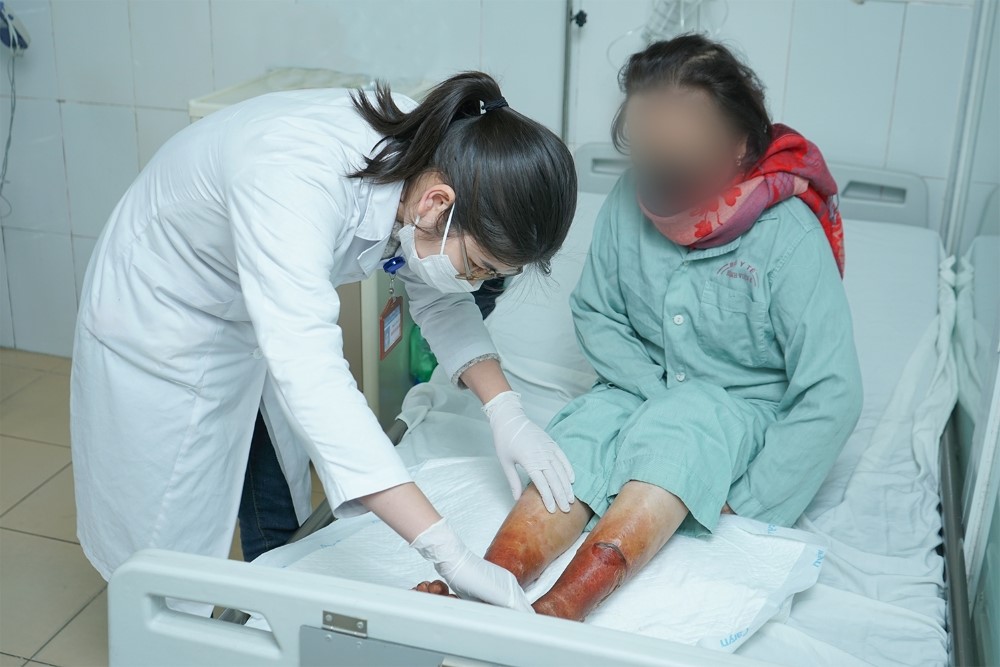7cbd5655-6318-4f9d-9011-76f4cf3f6a21_qedf Tổn thương da nặng, nhiễm trùng kéo dài vì sử dụng bột lá không rõ nguồn gốc - ảnh 1